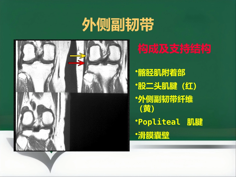 常见骨关节疾病MRI影像学表现_第13页