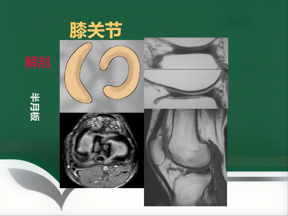 常见骨关节疾病MRI影像学表现_第8页