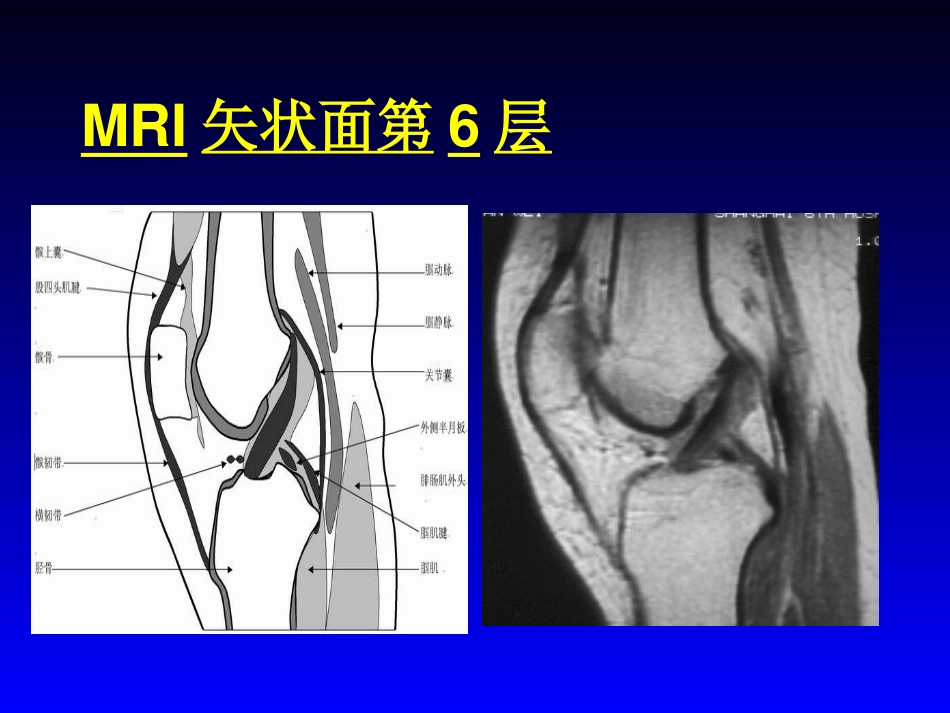 外影像与诊断学：膝关节MRI_第10页