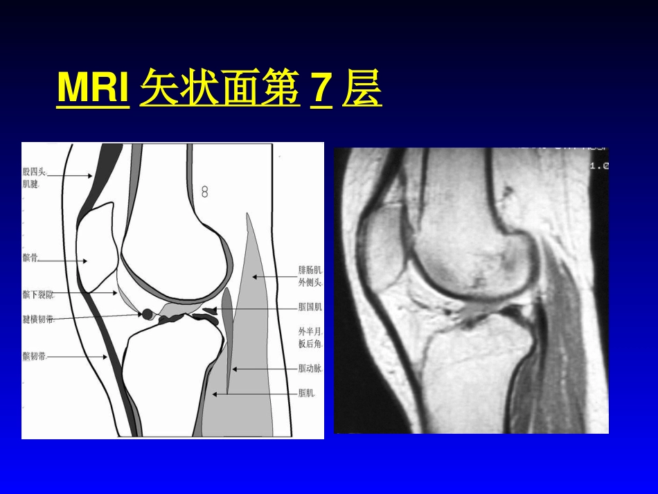 外影像与诊断学：膝关节MRI_第11页