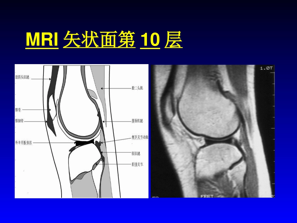 外影像与诊断学：膝关节MRI_第14页