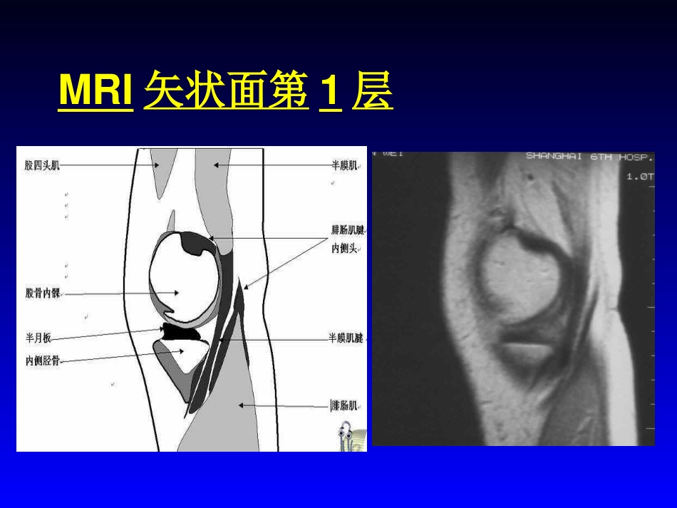 外影像与诊断学：膝关节MRI_第5页