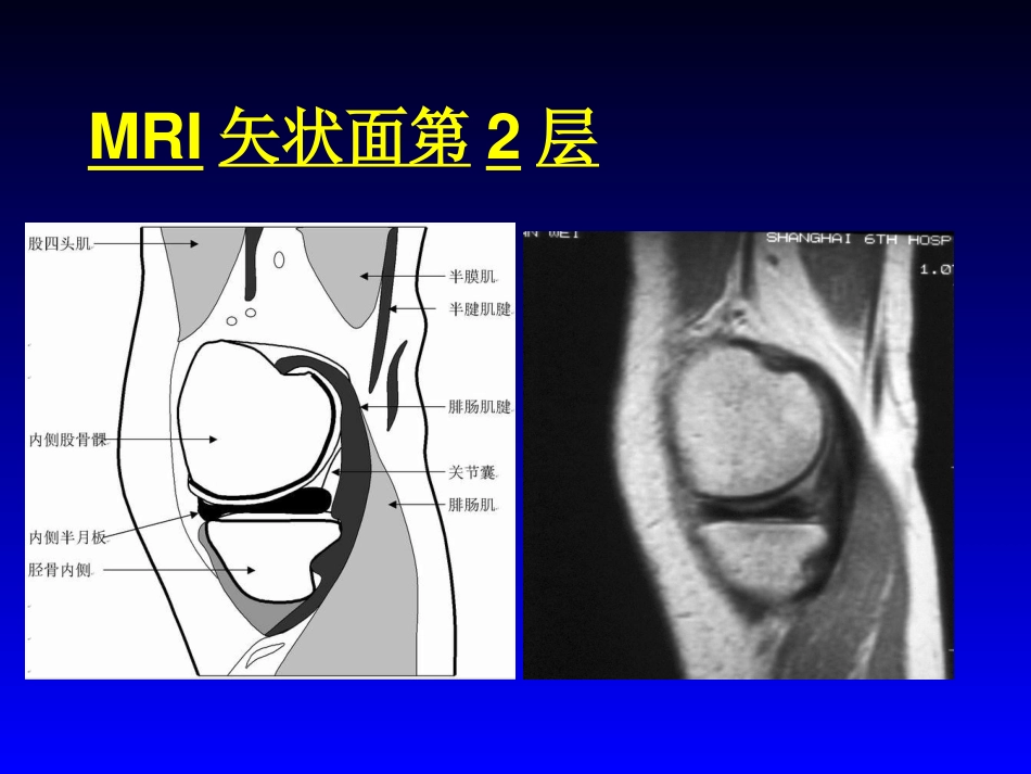 外影像与诊断学：膝关节MRI_第6页