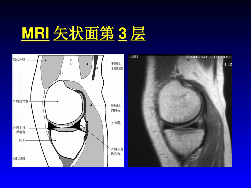 外影像与诊断学：膝关节MRI_第7页