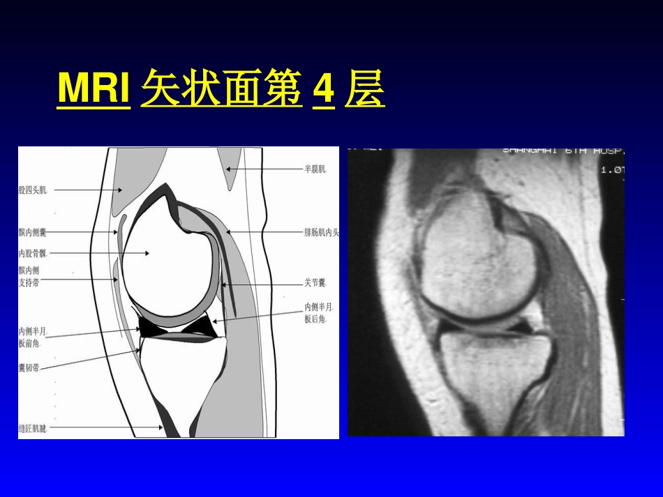 外影像与诊断学：膝关节MRI_第8页