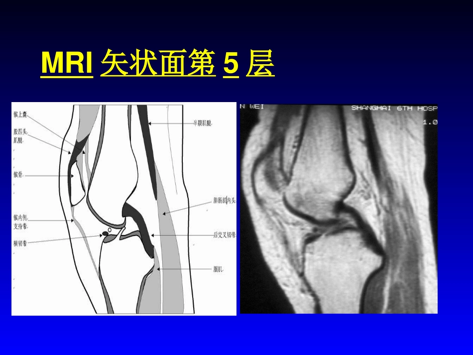 外影像与诊断学：膝关节MRI_第9页