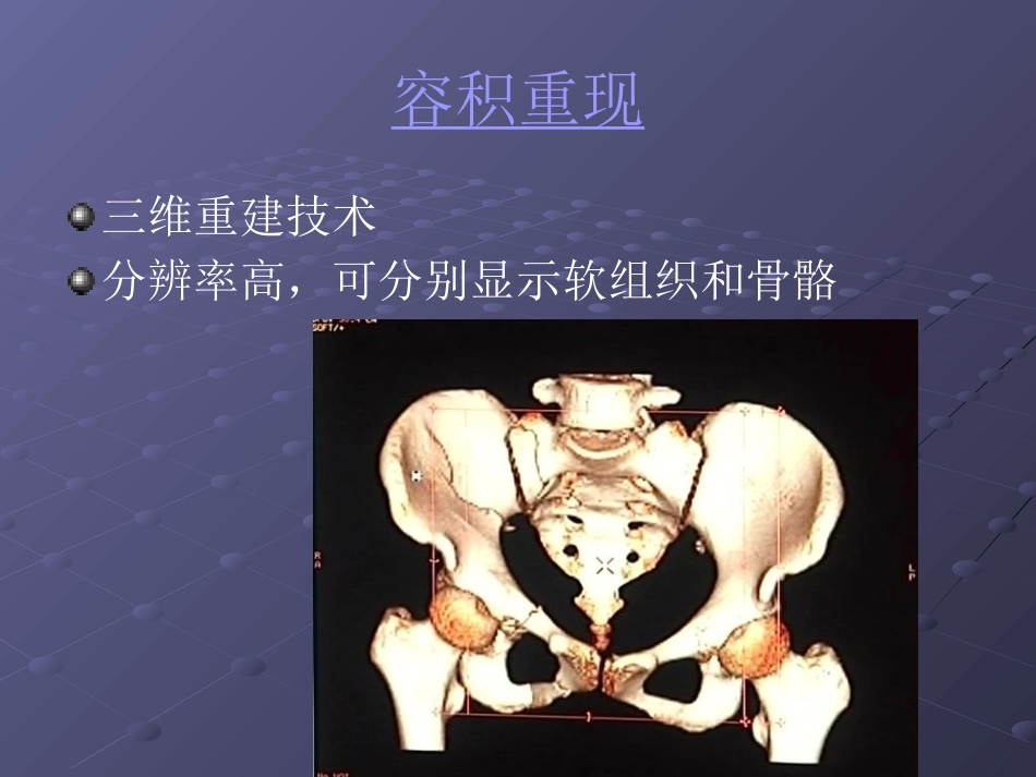 常见脊柱疾病影像学_第10页
