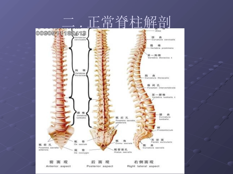 常见脊柱疾病影像学_第13页