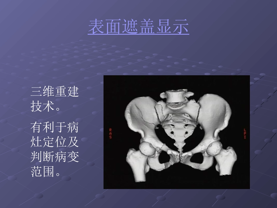 常见脊柱疾病影像学_第9页