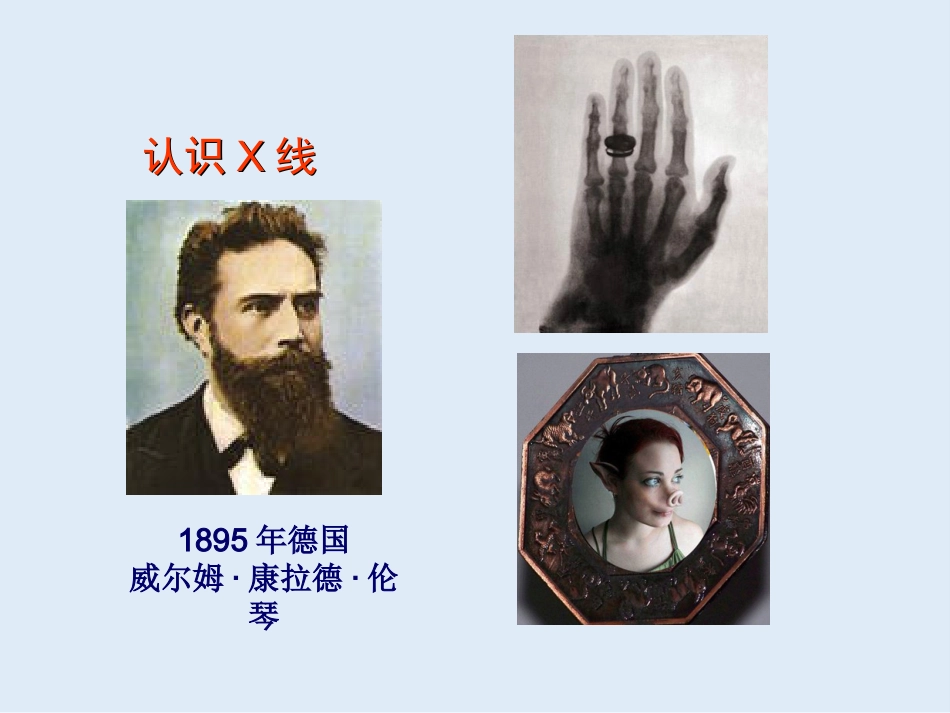 外影像与诊断学：创伤骨科X线片阅片技巧及易漏诊病例讨论_第2页