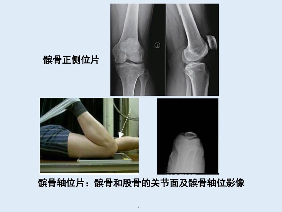 外影像与诊断学：创伤骨科X线片阅片技巧及易漏诊病例讨论_第7页