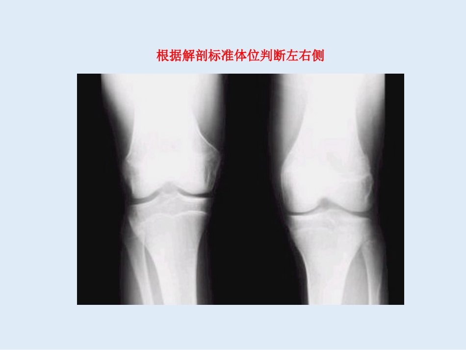 外影像与诊断学：创伤骨科X线片阅片技巧及易漏诊病例讨论_第9页