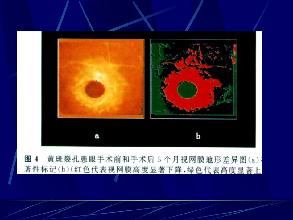 《眼科影像学》_第11页