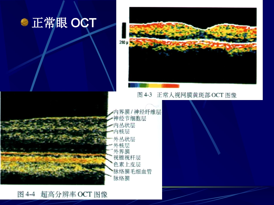 《眼科影像学》_第13页