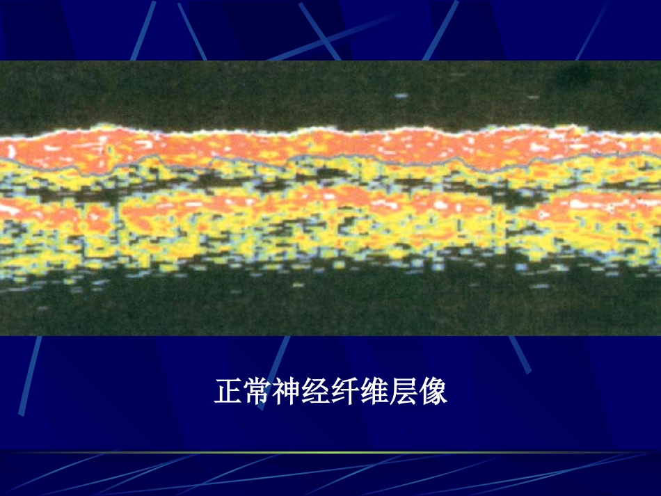 《眼科影像学》_第14页