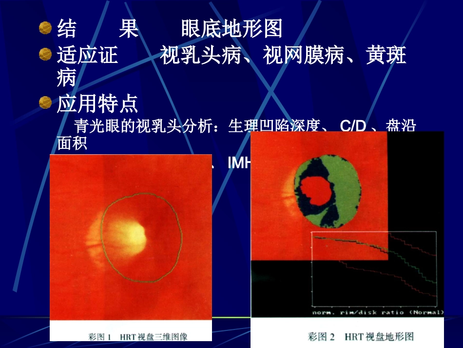 《眼科影像学》_第5页
