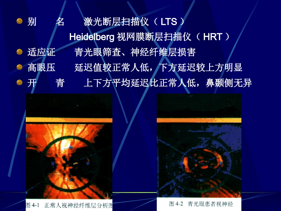 《眼科影像学》_第9页