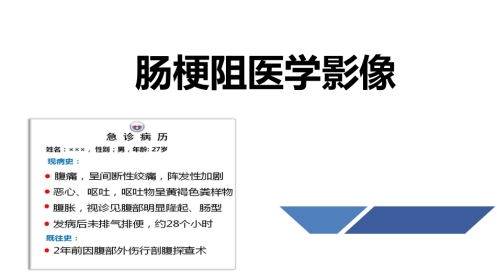 肠梗阻医学影像PPT