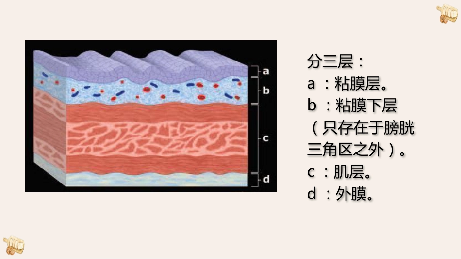 膀胱癌的影像诊断与鉴别诊断_第4页