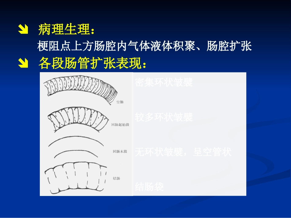 肠梗阻的分类及影像学表现(1)_第4页