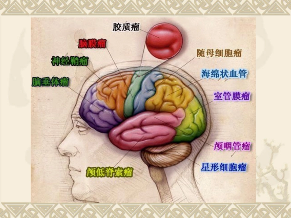 常见脑肿瘤的影像诊断(1)_第3页