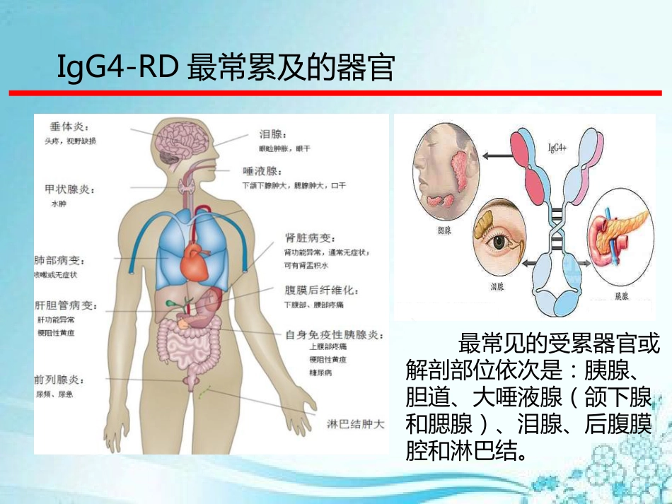 IgG4相关性疾病定义和具体的影像表现_第8页
