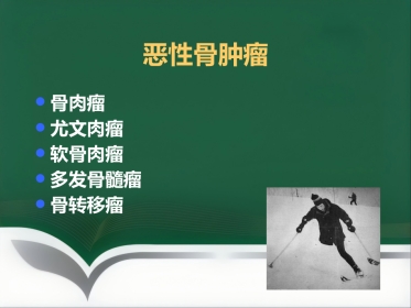 常见骨肿瘤影像诊断分析-5(其它)