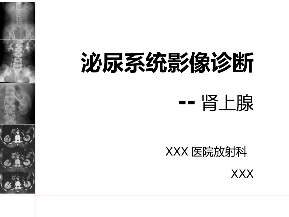《影像诊断学》教学课件11 影像诊断学(肾上腺)_第1页