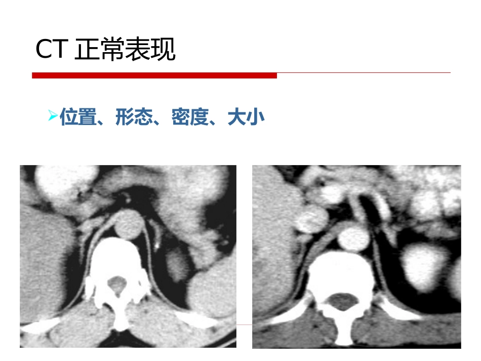 《影像诊断学》教学课件11 影像诊断学(肾上腺)_第9页