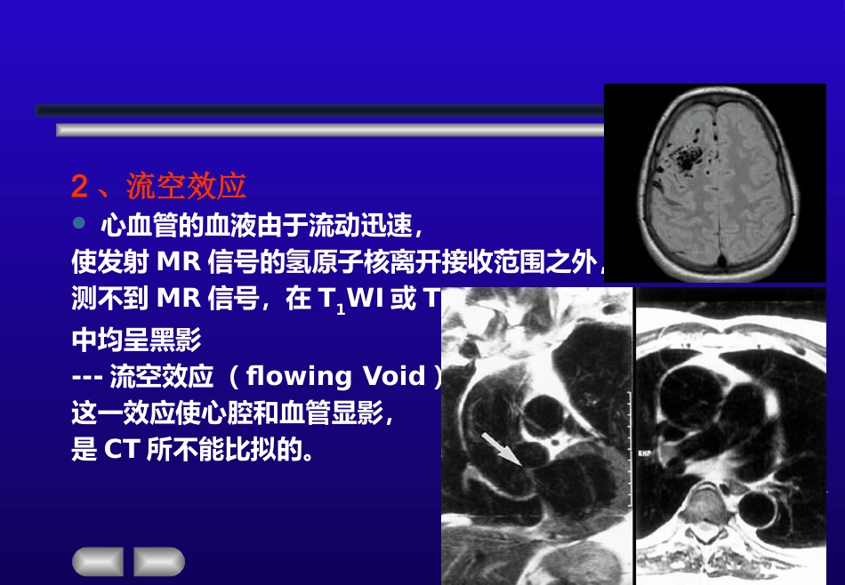 【影像诊断】MRI的临床应用【53页】_第10页