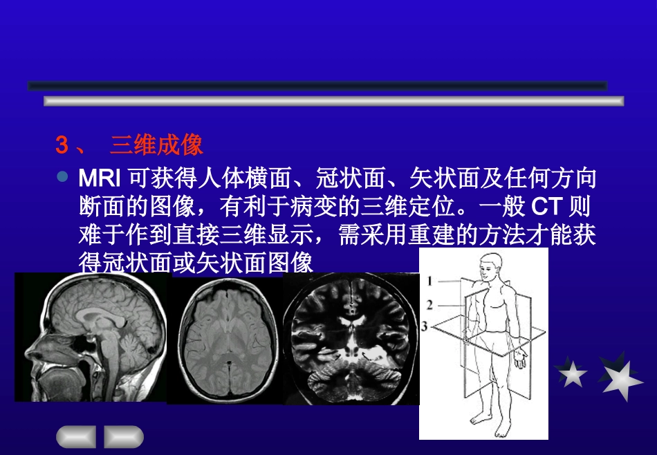 【影像诊断】MRI的临床应用【53页】_第11页
