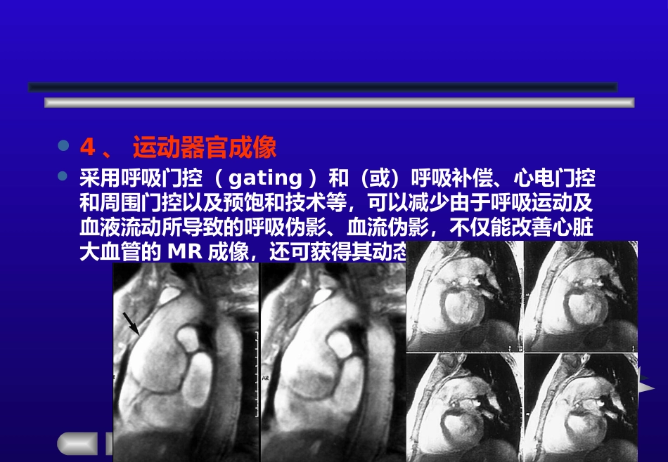 【影像诊断】MRI的临床应用【53页】_第12页
