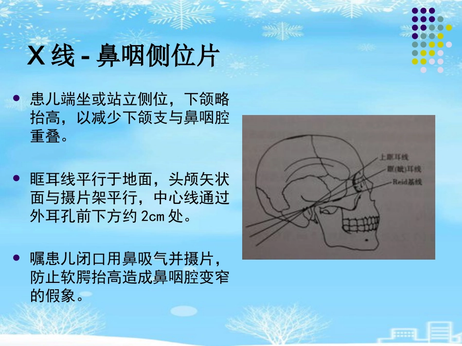 鼻咽腺样体肥大的影像诊断级2021PPT_第8页