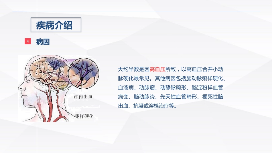 脑出血疾病介绍+术后护理_第5页