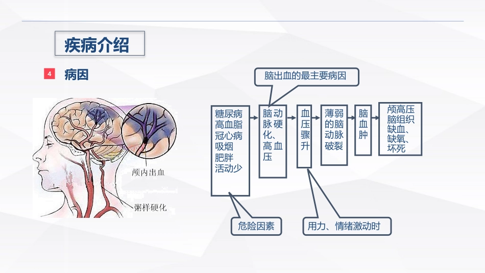 脑出血疾病介绍+术后护理_第6页