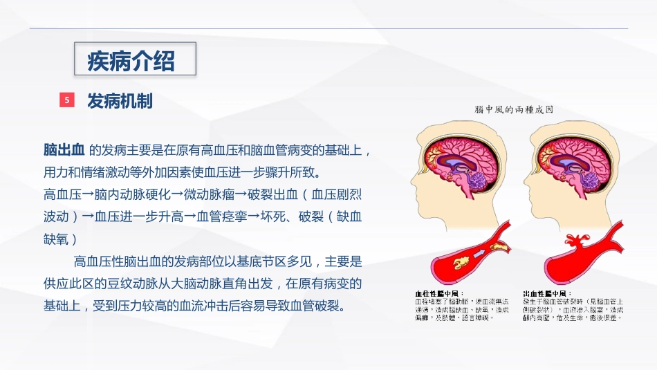 脑出血疾病介绍+术后护理_第7页