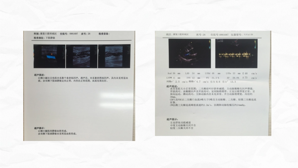 脑梗死个案护理_第11页