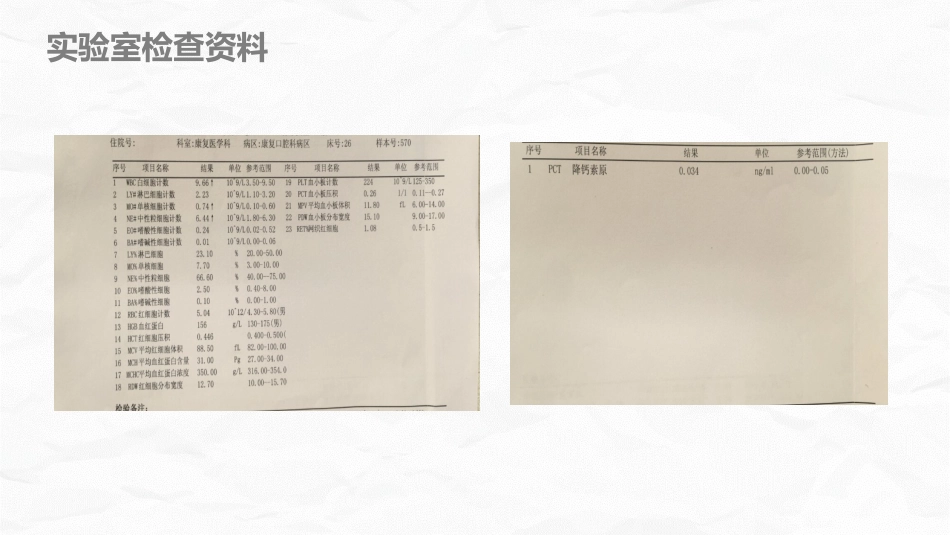 脑梗死个案护理_第13页