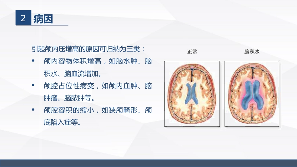 颅内压增高病人的护理_第6页