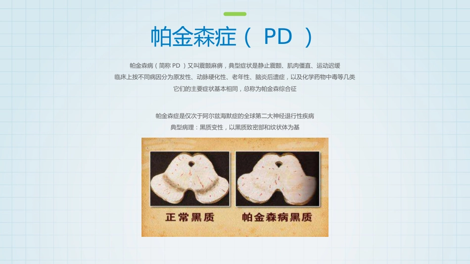 帕金森药物治疗_第4页