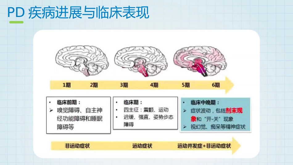 帕金森药物治疗_第6页