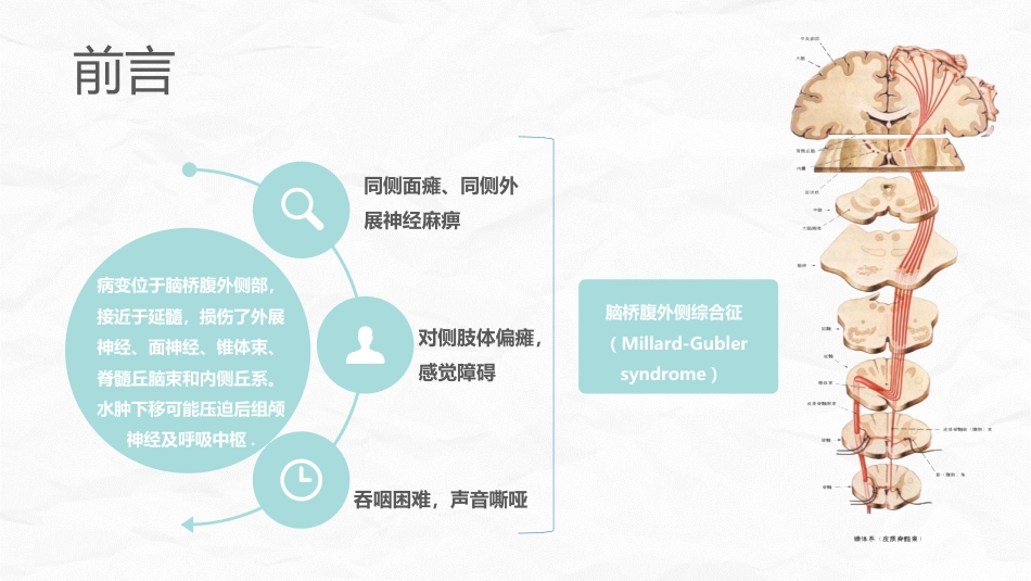 脑出血护理个案_第2页