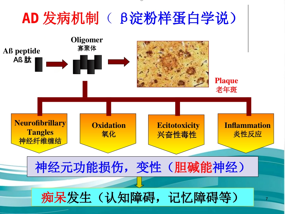 阿尔兹海默病的药物治疗研_第7页