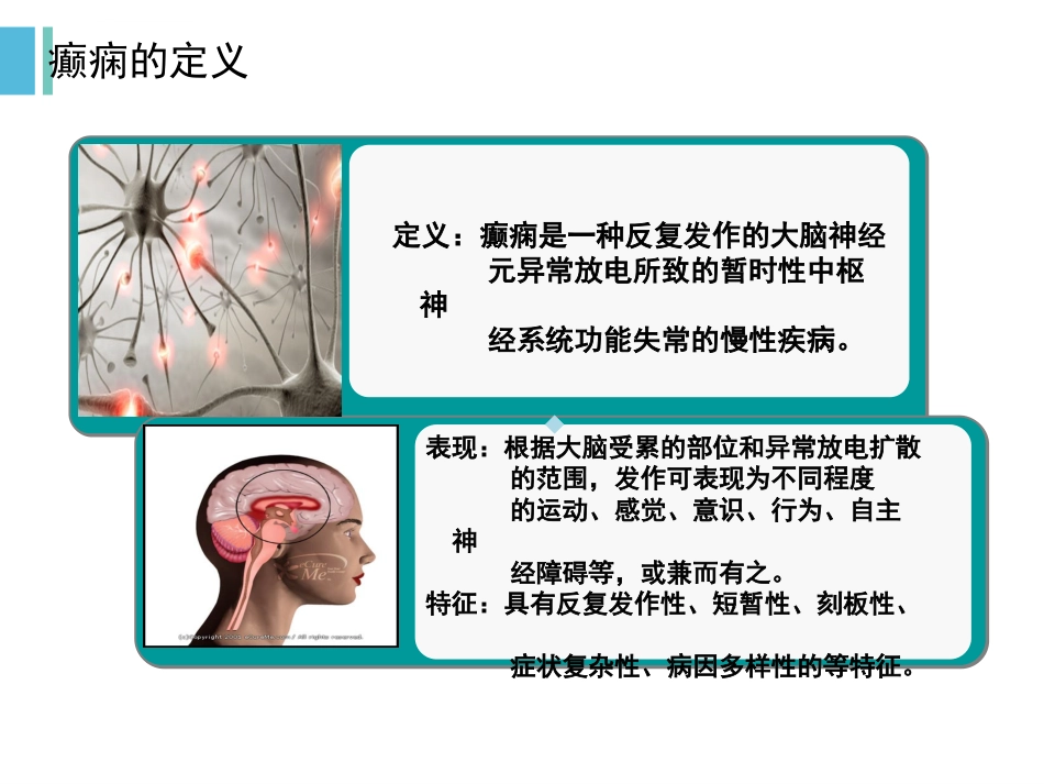 癫痫发作与护理ppt课件_第3页
