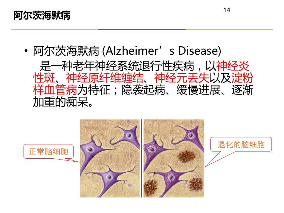 老年痴呆症诊治及合理用药_第14页