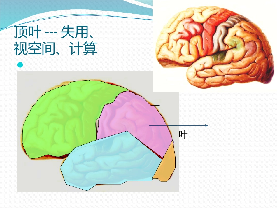 阿尔茨海默病_第15页