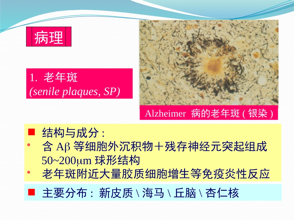 阿尔茨海默病_第6页