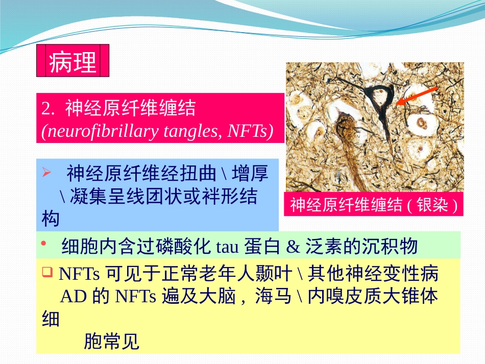 阿尔茨海默病_第7页