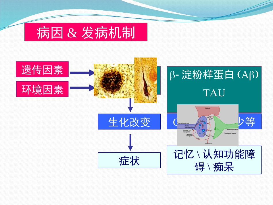 阿尔茨海默病_第8页