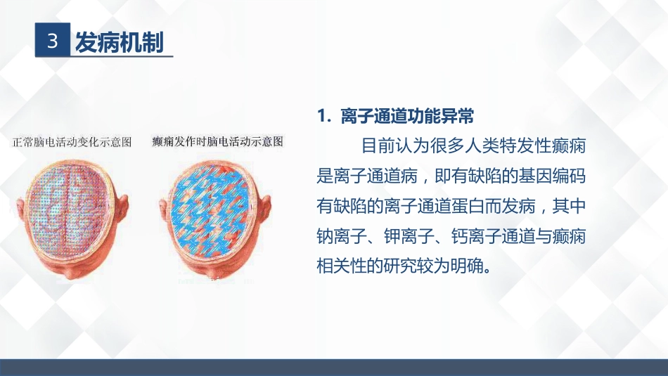 神经内科-癫痫的护理查房_第10页
